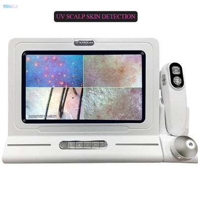 Portable Scalp Hair Scanner for White Hair Follicle Analysis and Pigmentation Testing