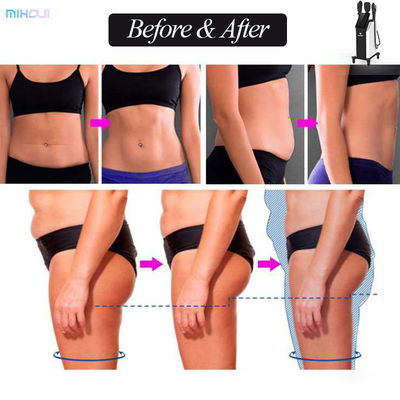 peface Beauty 5 In 1 Body Slimming Machine 4 Handles With 3600VA Power Consumption
