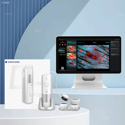 Desktop Hair Scalp Detector Professional With Dual System And Smart Switching